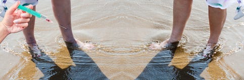 Le vene varicose e li rimuovono per iniezione Fotografia Stock Le vene varicose e li rimuovono per iniezione Fotografia Stock