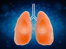 Lungs in pain stock photography Lungs in pain stock photography