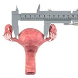 Macica z noniuszu caliper Badanie i diagnoza macicy pojęcie, 3D rendering ilustracji Macica z noniuszu caliper Badanie i diagnoza macicy pojęcie, 3D rendering ilustracji