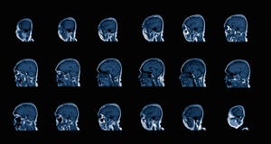 Magnetic resonance image MRI of the brain stock images Magnetic resonance image MRI of the brain stock images