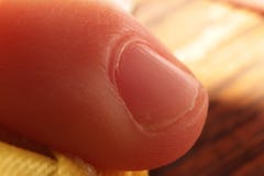 Makrokinderfinger mit gekautem Nagel stockfotos Makrokinderfinger mit gekautem Nagel stockfotos
