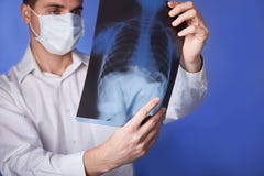 Male doctor in mask and white coat holding x-ray or roentgen of lungs, fluorography, image on blue background royalty free stock image Male doctor in mask and white coat holding x-ray or roentgen of lungs, fluorography, image on blue background royalty free stock image