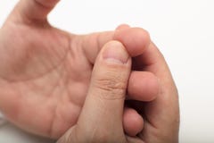 Man som pressar hans finger, når att ha stuckit det royaltyfri bild Man som pressar hans finger, når att ha stuckit det royaltyfri bild