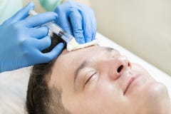 Mannen passerar en kurs av mesotherapy Royaltyfria Foton Mannen passerar en kurs av mesotherapy Royaltyfria Foton