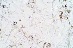 Marien aquatisch plankton onder microscoopmening stock fotografie Marien aquatisch plankton onder microscoopmening stock fotografie