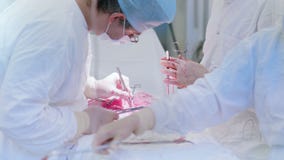 Medical team working in operating room performing surgical operation using surgery instrument stock video footage Medical team working in operating room performing surgical operation using surgery instrument stock video footage
