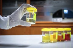 Medical urine test stock image Medical urine test stock image