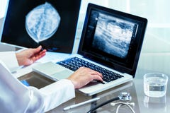Medico che esamina i risultati di mammografia sul pc fotografie stock libere da diritti Medico che esamina i risultati di mammografia sul pc fotografie stock libere da diritti