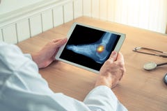 Medico che tiene una compressa digitale con i raggi x ed il dolore sulla caviglia del piede fotografia stock Medico che tiene una compressa digitale con i raggi x ed il dolore sulla caviglia del piede fotografia stock