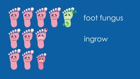 Medizinisches Konzept Fuß Podiatry Medizinisches Konzept Fuß Podiatry