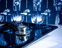 Medizinisches Stethoskop auf modernem digitalem Tabletten-PC stockbilder Medizinisches Stethoskop auf modernem digitalem Tabletten-PC stockbilder
