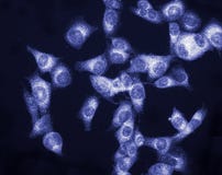 Melanoma Cancer Cell
