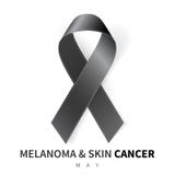 Melanoma Abcde Signs Vector Illustration Of Skin Patch With Skin