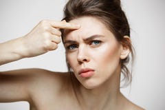 A menina moreno nova desagradou de sua pele da cara da acne do problema sobre o fundo branco Cosmetologia e skincare da saúde imagens de stock A menina moreno nova desagradou de sua pele da cara da acne do problema sobre o fundo branco Cosmetologia e skincare da saúde imagens de stock