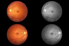 Menselijke ooganatomie, retina, optische schijfslagader en ader enz. stock fotografie Menselijke ooganatomie, retina, optische schijfslagader en ader enz. stock fotografie