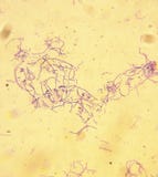 Microscope-Anthrax-Bacillus anthracis