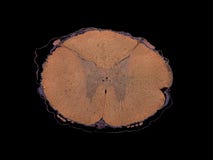 Spinal cord - cross section cut under the microscope – microscopic view of animal cells for education stock photo Spinal cord - cross section cut under the microscope – microscopic view of animal cells for education stock photo