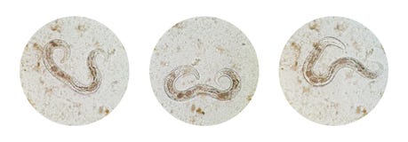Microscopic view collection of adult free-living female Strongyloides stercoralis, a human pathogenic parasitic roundworm causing stock images Microscopic view collection of adult free-living female Strongyloides stercoralis, a human pathogenic parasitic roundworm causing stock images