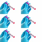 Mixed Of Blood Sample Tubes For Influenza Virus Test Stock Photography