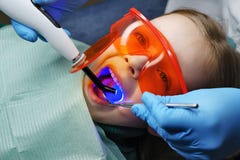 Filling of milk teeth. Dental clinic stock photos Filling of milk teeth. Dental clinic stock photos