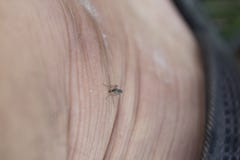 Mosquito bites leg royalty free stock photos Mosquito bites leg royalty free stock photos