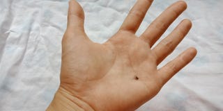 Mosquito and blood on human hands. royalty free stock photography Mosquito and blood on human hands. royalty free stock photography