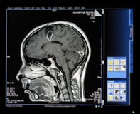 Mri obrazu cyfrowego monitor zdjęcie royalty free Mri obrazu cyfrowego monitor zdjęcie royalty free
