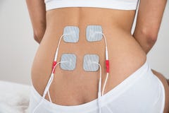 Mujer con los electrodos en ella detrás imagen de archivo libre de regalías Mujer con los electrodos en ella detrás imagen de archivo libre de regalías