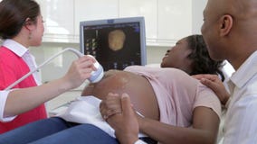Mujer embarazada que tiene exploración del ultrasonido 4D con el socio almacen de video Mujer embarazada que tiene exploración del ultrasonido 4D con el socio almacen de video