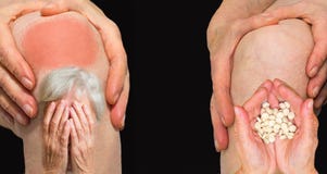 Mujer mayor que sostiene la rodilla con dolor imagenes de archivo Mujer mayor que sostiene la rodilla con dolor imagenes de archivo
