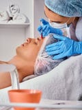 Napełniacza zastrzyk dla męskiej twarzy Plastikowa twarzowa operacja w piękno klinice zdjęcie stock Napełniacza zastrzyk dla męskiej twarzy Plastikowa twarzowa operacja w piękno klinice zdjęcie stock