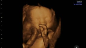 Nariz Del Frotamiento Del Bebe Y El Jugar Con El Cordon Umbilical En Matriz De Las Madres Metrajes Video De Flujo Aborto Nariz Del Frotamiento Del Bebe Y El Jugar Con El Cordon Umbilical En Matriz De Las Madres Metrajes Video De Flujo Aborto