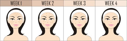 Nessun'acne Nessun'acne
