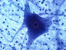 Neurone microscopique image libre de droits Neurone microscopique image libre de droits