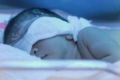 Newborn младенец с неонатальной желтухой под голубым ультрафиолетовым светом стоковые изображения Newborn младенец с неонатальной желтухой под голубым ультрафиолетовым светом стоковые изображения