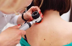 O dermatologista examina as toupeiras ou a acne do paciente com um dermatoscope imagens de stock O dermatologista examina as toupeiras ou a acne do paciente com um dermatoscope imagens de stock