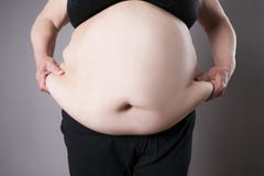 Obesity female body, fat woman belly close up