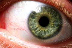 Ojo malvado Ojo malvado