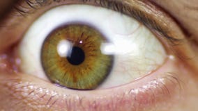 Ojos sorprendidos Ojos sorprendidos