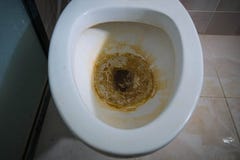 old-dirty-sanitary-domestic-toilet-61437283.jpg