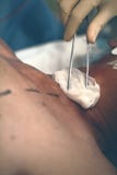 Ossequi medici dell'infermiere del paziente maschio con il tampone della garza nel disinfec fotografia stock Ossequi medici dell'infermiere del paziente maschio con il tampone della garza nel disinfec fotografia stock