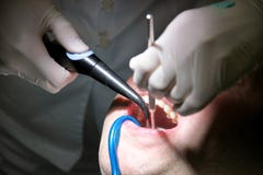 Outil dentaire pour rincer des dents Dents nettoyant, hygiène dentaire Le dentiste est rinicage des dents patientes avec le jet d photographie stock Outil dentaire pour rincer des dents Dents nettoyant, hygiène dentaire Le dentiste est rinicage des dents patientes avec le jet d photographie stock