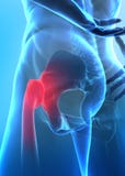 Pain in hip concept