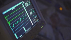 Pan of a patient and monitor in dark room
