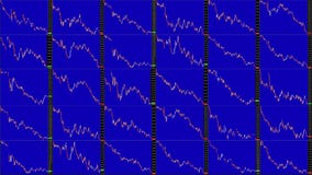 Pantalla de Timelapse Tiempo rápido Análisis técnico del mercado Banda de fuctuación Pantalla de Timelapse Tiempo rápido Análisis técnico del mercado Banda de fuctuación