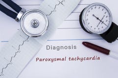 Papierowa medyczna uwolnienie forma z diagnozą Napadowy częstoskurcz od kategorii Sercowego arrhythmia chorob z drukowanym ECG, s zdjęcie stock Papierowa medyczna uwolnienie forma z diagnozą Napadowy częstoskurcz od kategorii Sercowego arrhythmia chorob z drukowanym ECG, s zdjęcie stock