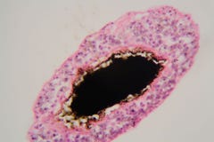 Parasita do mansoni do Schistosoma sob o microscópio imagem de stock Parasita do mansoni do Schistosoma sob o microscópio imagem de stock