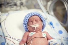 Pasgeboren voorbarige baby in het NICU-intensive care royalty-vrije stock foto's Pasgeboren voorbarige baby in het NICU-intensive care royalty-vrije stock foto's