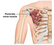 Pectoralis δευτερεύουσα ανατομία μυών, τρισδιάστατη ιατρική διανυσματική απεικόνιση στο άσπρο υπόβαθρο απεικόνιση αποθεμάτων Pectoralis δευτερεύουσα ανατομία μυών, τρισδιάστατη ιατρική διανυσματική απεικόνιση στο άσπρο υπόβαθρο απεικόνιση αποθεμάτων