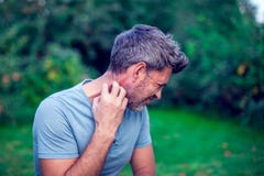 People scratch the itch with hand, Elbow, itching, Healthcare An stock image People scratch the itch with hand, Elbow, itching, Healthcare An stock image